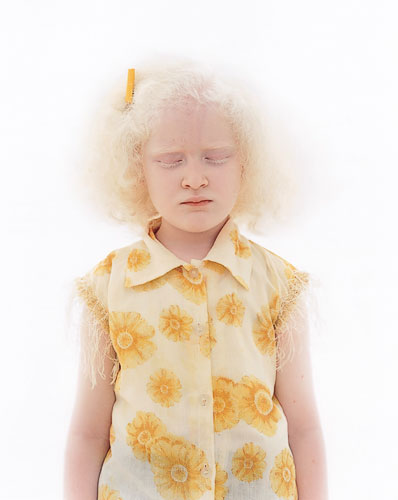 [Indian albino girl]